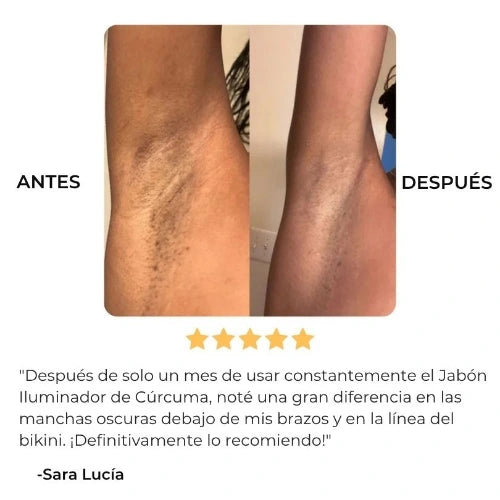 DermaLuz™ – Jabón que Aclara y Protege